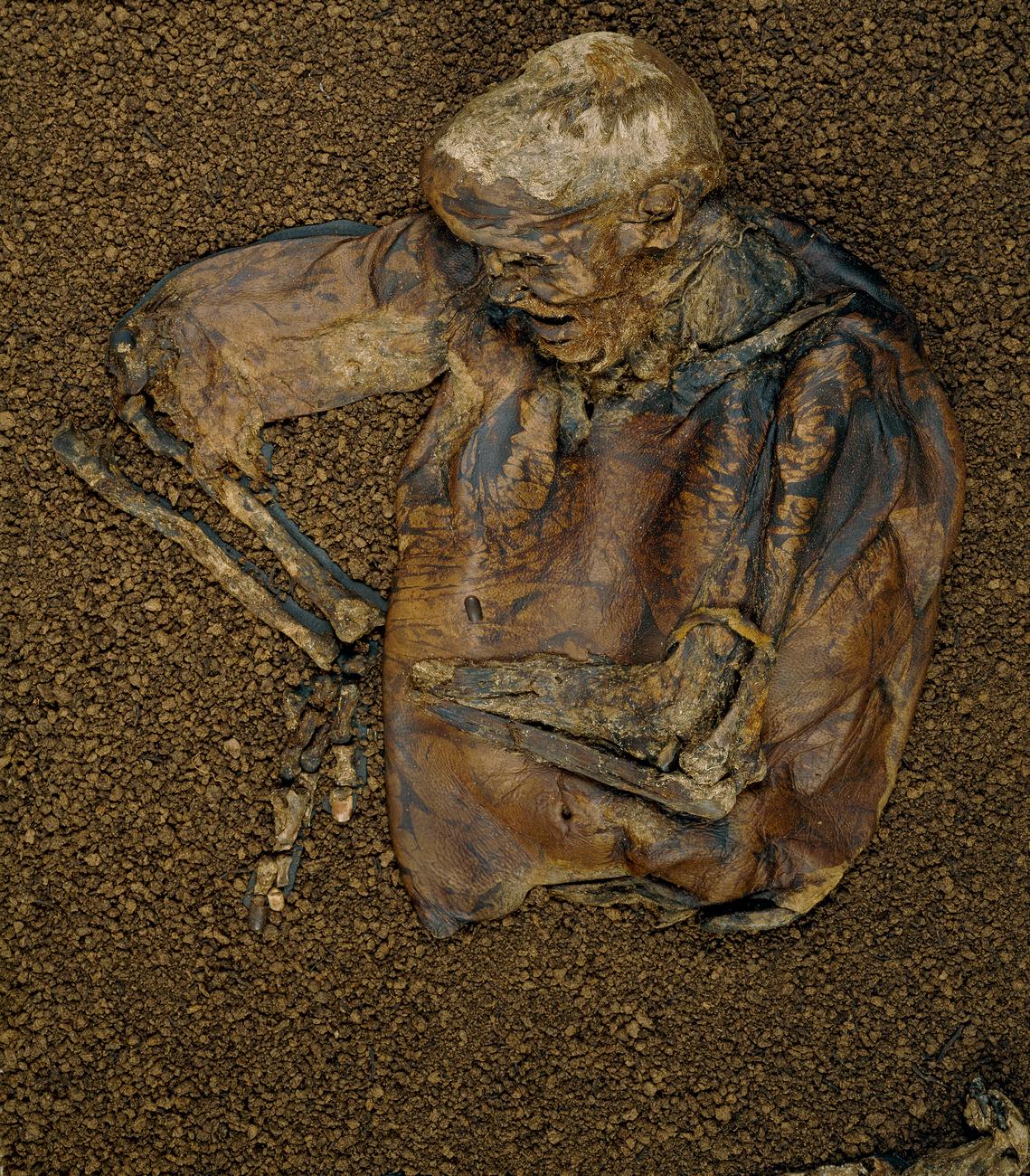 Lindow Man